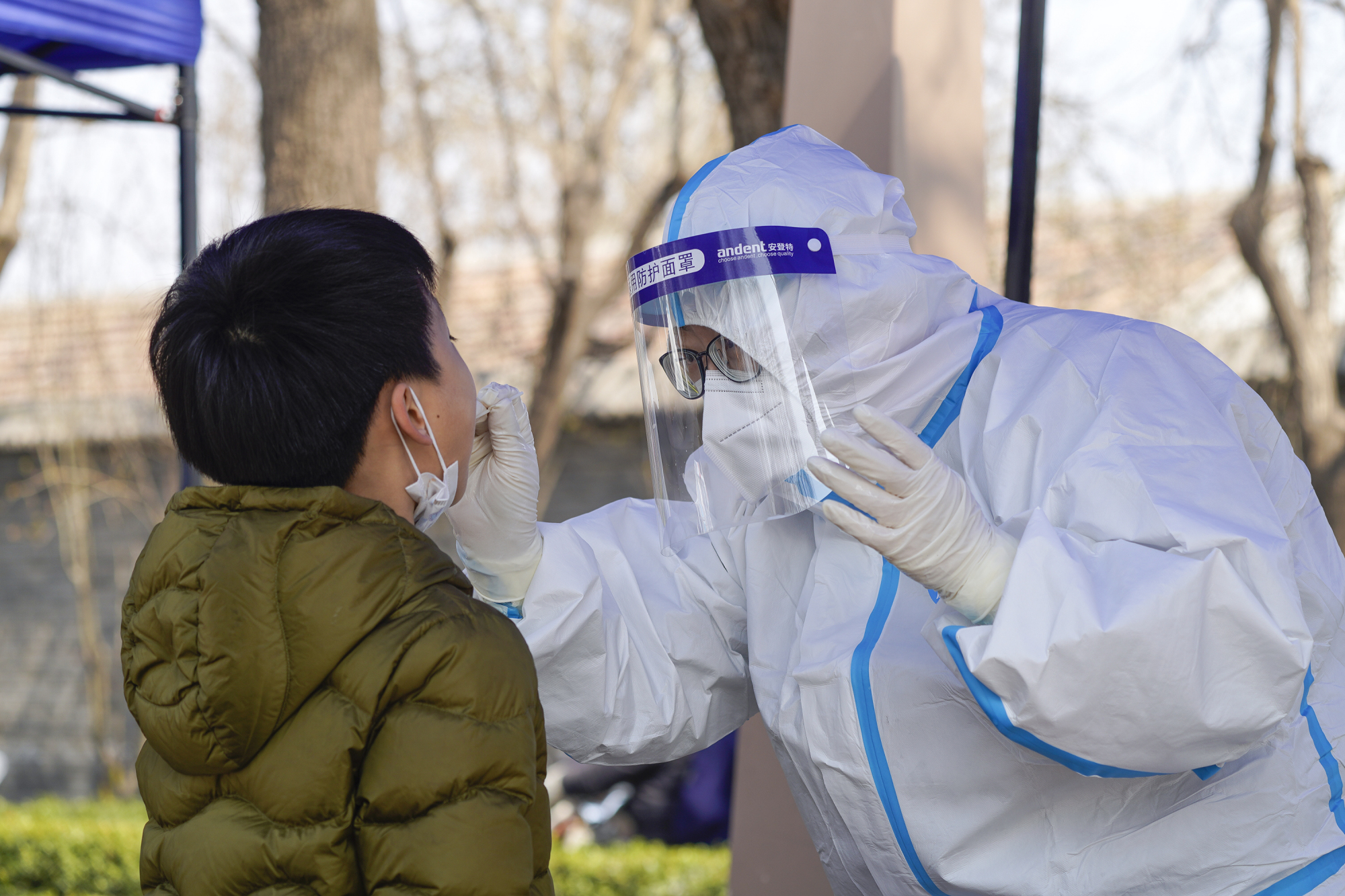 疫情地区核酸检测收费吗/疫情期间核酸检测收费吗?-第1张图片